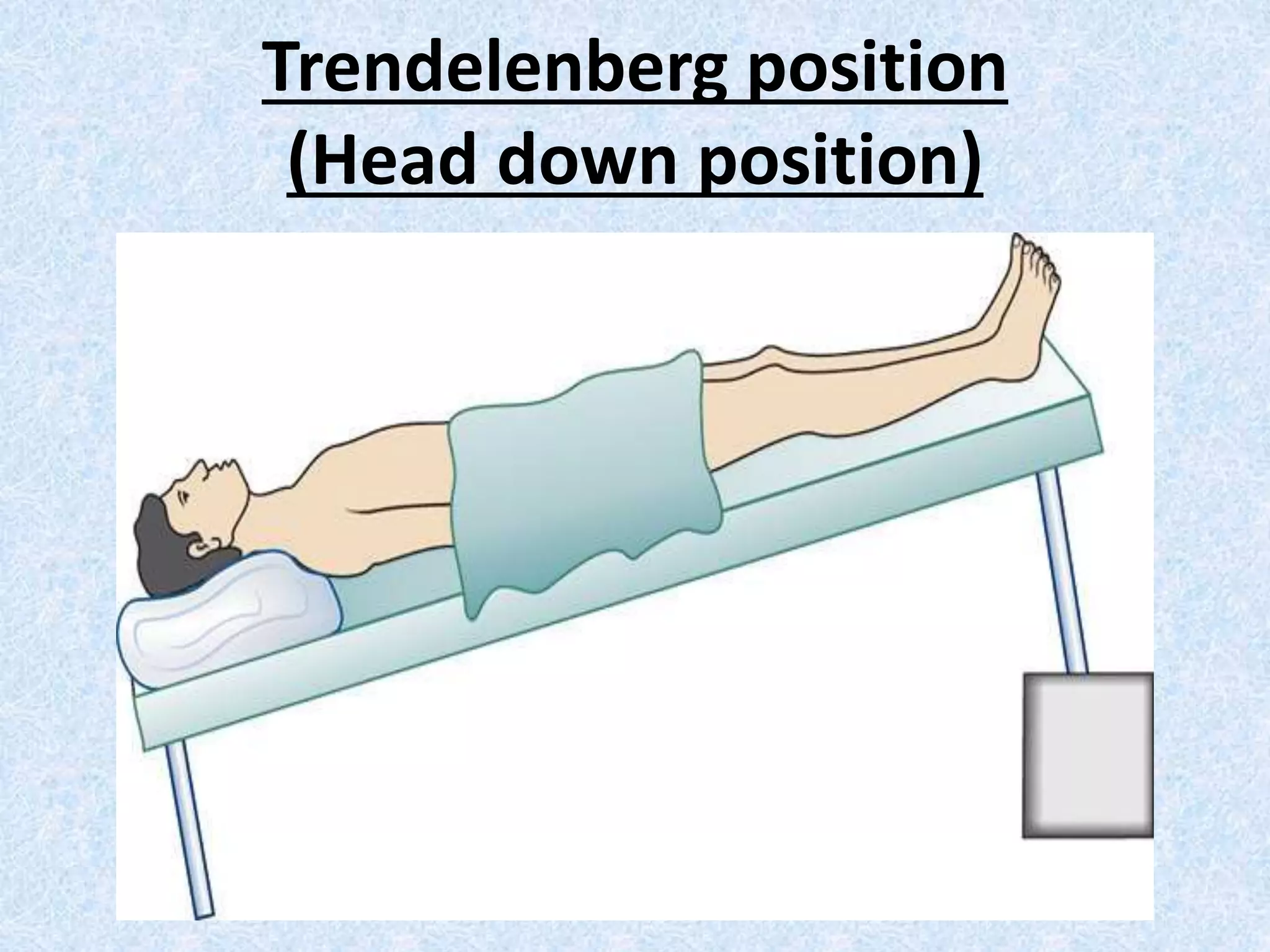 Trendelenberg position
(Head down position)
 