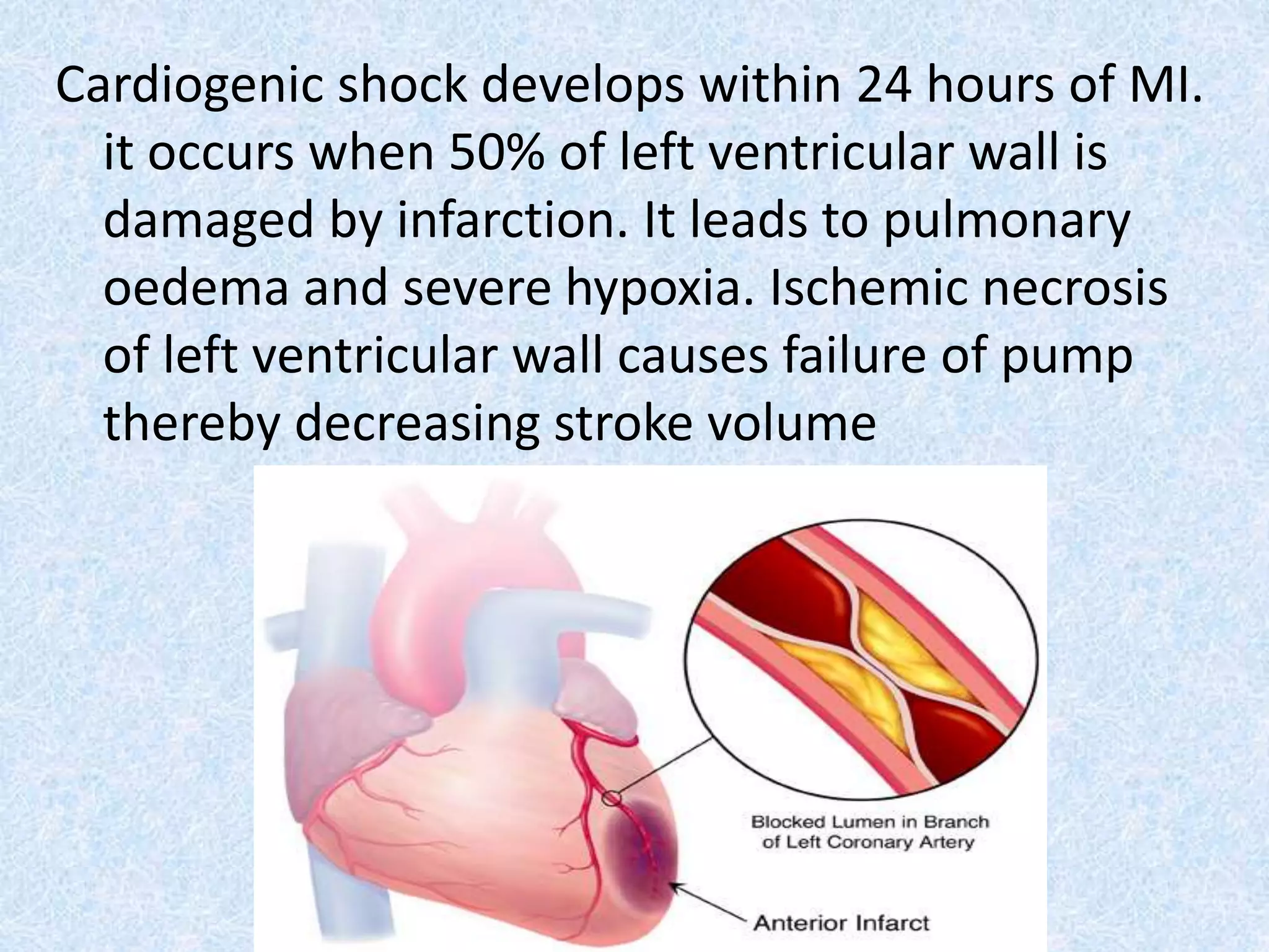 Cardiogenic shock develops within 24 hours of MI.
it occurs when 50% of left ventricular wall is
damaged by infarction. It leads to pulmonary
oedema and severe hypoxia. Ischemic necrosis
of left ventricular wall causes failure of pump
thereby decreasing stroke volume
 