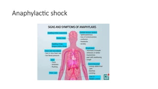 Shock Ravi Shock- Dr Ravi Meenkdkdjfjcjdjdjcjdka.pptx