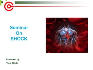 Presented by
Tulsi Dhidhi
Seminar
On
SHOCK
 