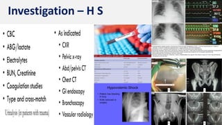 Investigation – H S
 