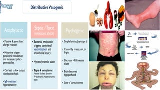 Shock - Septic + Hypovolemic - Causes & Management | PDF