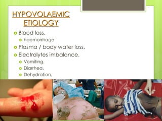 HYPOVOLAEMIC
ETIOLOGY
 Blood loss.
 haemorrhage
 Plasma / body water loss.
 Electrolytes imbalance.
 Vomiting.
 Diarrhea.
 Dehydration.
 