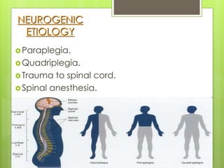 NEUROGENIC
ETIOLOGY
Paraplegia.
Quadriplegia.
Trauma to spinal cord.
Spinal anesthesia.
 