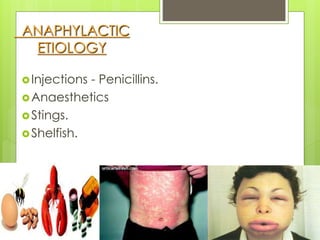 ANAPHYLACTIC
ETIOLOGY
Injections - Penicillins.
Anaesthetics
Stings.
Shelfish.
 
