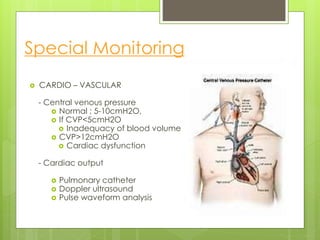 Special Monitoring
 CARDIO – VASCULAR
- Central venous pressure
 Normal ; 5-10cmH2O,
 If CVP<5cmH2O
 Inadequacy of blood volume
 CVP>12cmH2O
 Cardiac dysfunction
- Cardiac output
 Pulmonary catheter
 Doppler ultrasound
 Pulse waveform analysis
 
