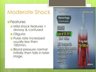 Moderate Shock
Features
 Mild shock features +
drowsy & confused
 Oliguria
 Pulse rate increased
usually less then
100/min.
 Blood pressure normal
initially then falls in later
stage.
 