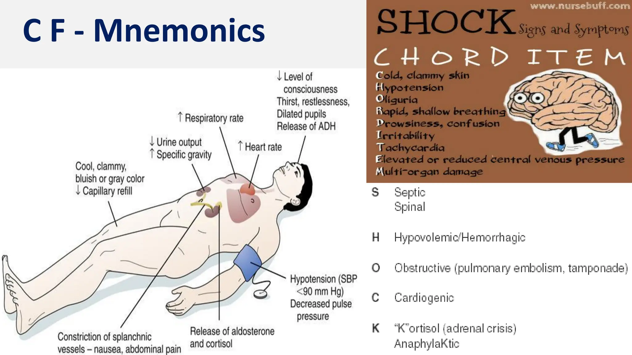 Shock Information.pdf Shock - Types, PP & MGT | PDF