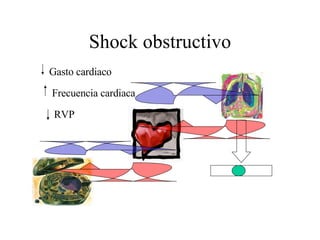 Shock obstructivo Gasto cardiaco Frecuencia cardiaca RVP 