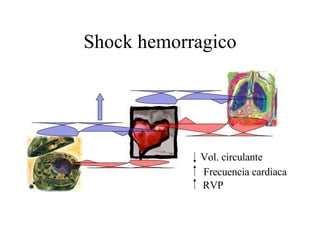 Shock hemorragico Vol. circulante Frecuencia cardiaca RVP 