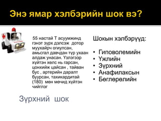 55 настай Т асуумжинд
гэнэт зүрх дэлсэж дотор
муухайрч огиулсан,
амьсгал давчдан түр ухаан
алдаж унасан. Үзлэгээр
хүйтэн хөлс нь гарсан,
цонхийж цайсан , тайван
бус , артерийн даралт
буурсан, тахикардитай
(180) мөн мөчид хүйтэн
чийглэг

Зүрхний шок

Шокын хэлбэрүүд:
•
•
•
•
•

Гиповолемийн
Үжлийн
Зүрхний
Анафилаксын
Бөглөрөлийн

 