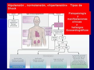 Hipotensión , normotensión, «hipertensión» Tipos de
Shock
Fisiopatología
y
manifestaciones
clínicas
y
hallazgos
Ecocardiográficos
 