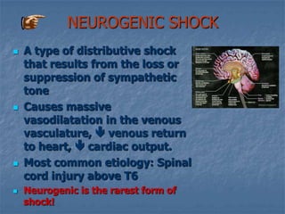 Pulmonary interstitial & intraalveolar edema !!!!Clinical PresentationCardiogenic ShockSimilar catecholamine compensation changes in generalized shock & hypovolemic shockMay not show typical tachycardic response :if pt on Beta blockers, in heart block, or if bradycardic in response to nodal tissue ischemiaMean arterial pressure below 70 mmHg compromises coronary perfusion(MAP = SBP + (2) DBP/3)