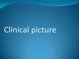 Clinical picture