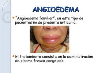ANGIOEDEMAANGIOEDEMA
“Angioedema familiar”, en este tipo de
pacientes no se presenta urticaria.
El tratamiento consiste en la administración
de plasma fresco congelado.
 