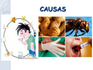CAUSASCAUSAS
 