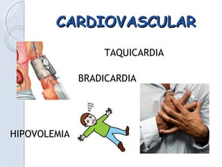 CARDIOVASCULARCARDIOVASCULAR
TAQUICARDIA
BRADICARDIA
HIPOVOLEMIA
 
