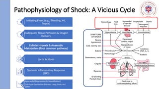 Shock Explained SHOCK, TYPES AND MANAGEMENT - SUSHIL GYAWALI.pptx
