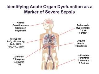 Identifying Acute Organ Dysfunction as a
Marker of Severe Sepsis
Tachycardia
Hypotension
 CVP
 PAOP
Jaundice
 Enzymes
 Albumin
 PT
Altered
Consciousness
Confusion
Psychosis
Tachypnea
PaO2 <70 mm Hg
SaO2 <90%
PaO2/FiO2 300
Oliguria
Anuria
 Creatinine
 Platelets
 PT/APTT
 Protein C
 D-dimer
 