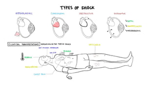 Comprehensive Overview of Shock: Types, Pathogenesis, and Management | PPTX