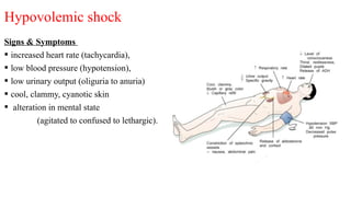 Comprehensive Overview of Shock: Types, Pathogenesis, and Management | PPTX
