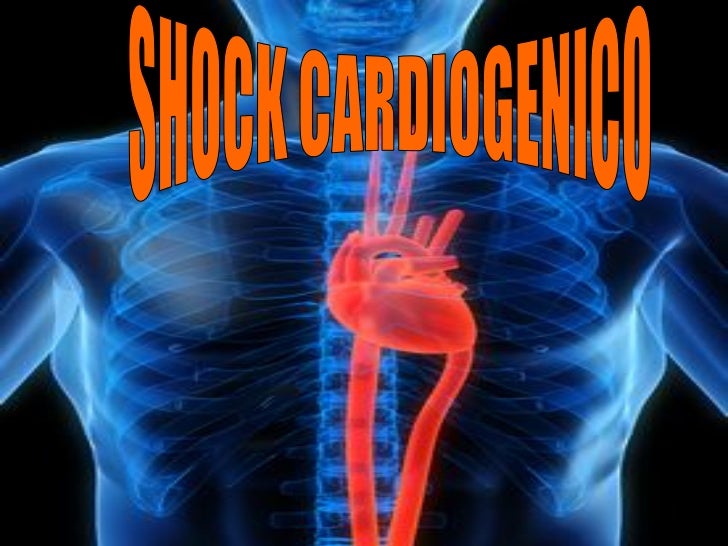 Shock cardiogenico