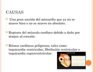 CAUSAS
 Una gran sección del miocardio que ya no se
mueve bien o no se mueve en absoluto.
 Ruptura del músculo cardíaco debido a daño por
ataque al corazón.
 Ritmos cardíacos peligrosos, tales como
taquicardia ventricular, fibrilación ventricular o
taquicardia supraventricular.
 
