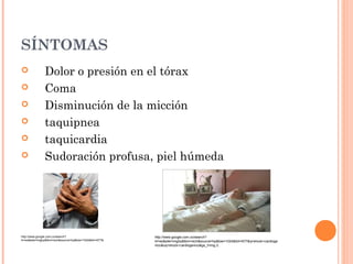 SÍNTOMAS
 Dolor o presión en el tórax
 Coma
 Disminución de la micción
 taquipnea
 taquicardia
 Sudoración profusa, piel húmeda
http://www.google.com.co/search?
hl=es&site=imghp&tbm=isch&source=hp&biw=1024&bih=677&q=shock+cardioge
nico&oq=shock+cardiogenico&gs_l=img.3..
http://www.google.com.co/search?
hl=es&site=imghp&tbm=isch&source=hp&biw=1024&bih=677&
 
