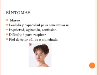SÍNTOMAS
 Mareo
 Pérdida y capacidad para concentrarse
 Inquietud, agitación, confusión
 Dificultad para respirar
 Piel de color pálido o manchada
 