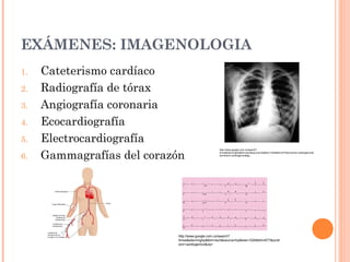EXÁMENES: IMAGENOLOGIA
1. Cateterismo cardíaco
2. Radiografía de tórax
3. Angiografía coronaria
4. Ecocardiografía
5. Electrocardiografía
6. Gammagrafías del corazón
http://www.google.com.co/search?
hl=es&site=imghp&tbm=isch&source=hp&biw=1024&bih=677&q=sh
ock+cardiogenico&oq=
http://www.google.com.co/search?
hl=es&site=imghp&tbm=isch&source=hp&biw=1024&bih=677&q=shock+cardiogenico&
oq=shock+cardiogenico&gs_
 