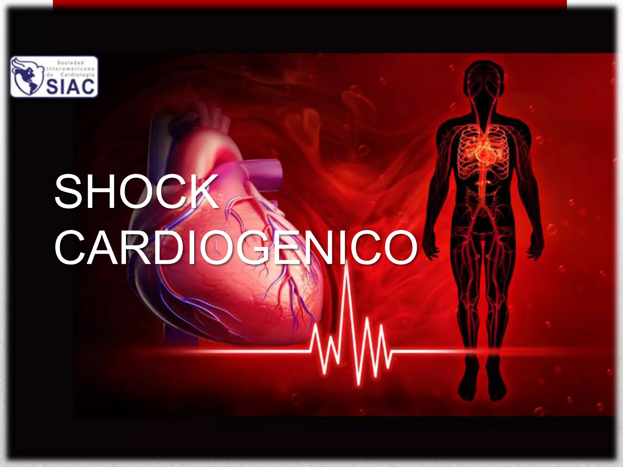 SHOCK CARDIOGENICO.pptx