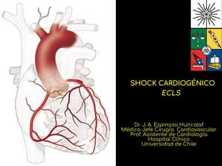 SHOCK CARDIOGÉNICO
ECLS
Dr. J. A. Espinoza Huircalaf
Médico Jefe Cirugía Cardiovascular
Prof. Asistente de Cardiología
Hospital Clínico
Universidad de Chile
1
 