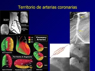 Territorio de arterias coronarias 