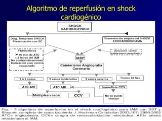 Algoritmo de reperfusión en shock cardiogénico 