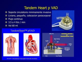 Tandem Heart p VAD Soporte circulatorio minimamente invasivo Liviano, pequeño, colocacion paracorporal Flujo continuo 3.5 a 4 ltrs / min Vol 60 ml 