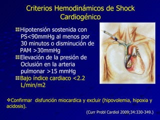 Criterios Hemodinámicos de Shock Cardiogénico Hipotensión sostenida con PS<90mmHg al menos por 30 minutos o disminución de PAM >30mmHg Elevación de la presión de  Oclusión en la arteria pulmonar >15 mmHg Bajo índice cardiaco  <2.2 L/min/m2 Confirmar  disfunción miocardica y excluir (hipovolemia, hipoxia y acidosis). (Curr Probl Cardiol 2009;34:330-349.) 