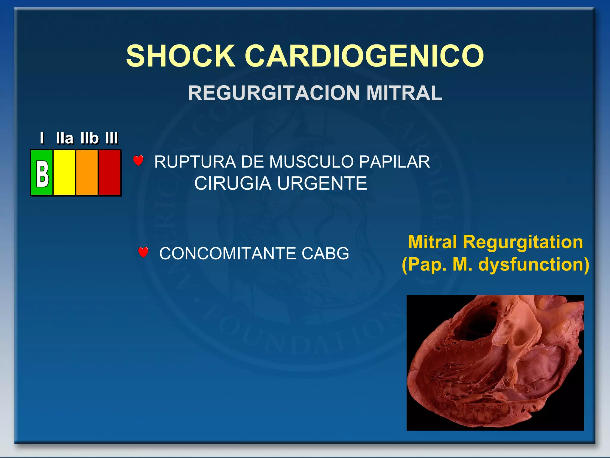 SHOCK CARDIOGENICO RUPTURA DE MUSCULO PAPILAR CIRUGIA URGENTE REGURGITACION MITRAL CONCOMITANTE CABG Mitral Regurgitation (Pap. M. dysfunction) I I I IIa IIa IIa IIb IIb IIb III III III I I I IIa IIa IIa IIb IIb IIb III III III I I I IIa IIa IIa IIb IIb IIb III III III IIa IIa IIa IIb IIb IIb III III III B 