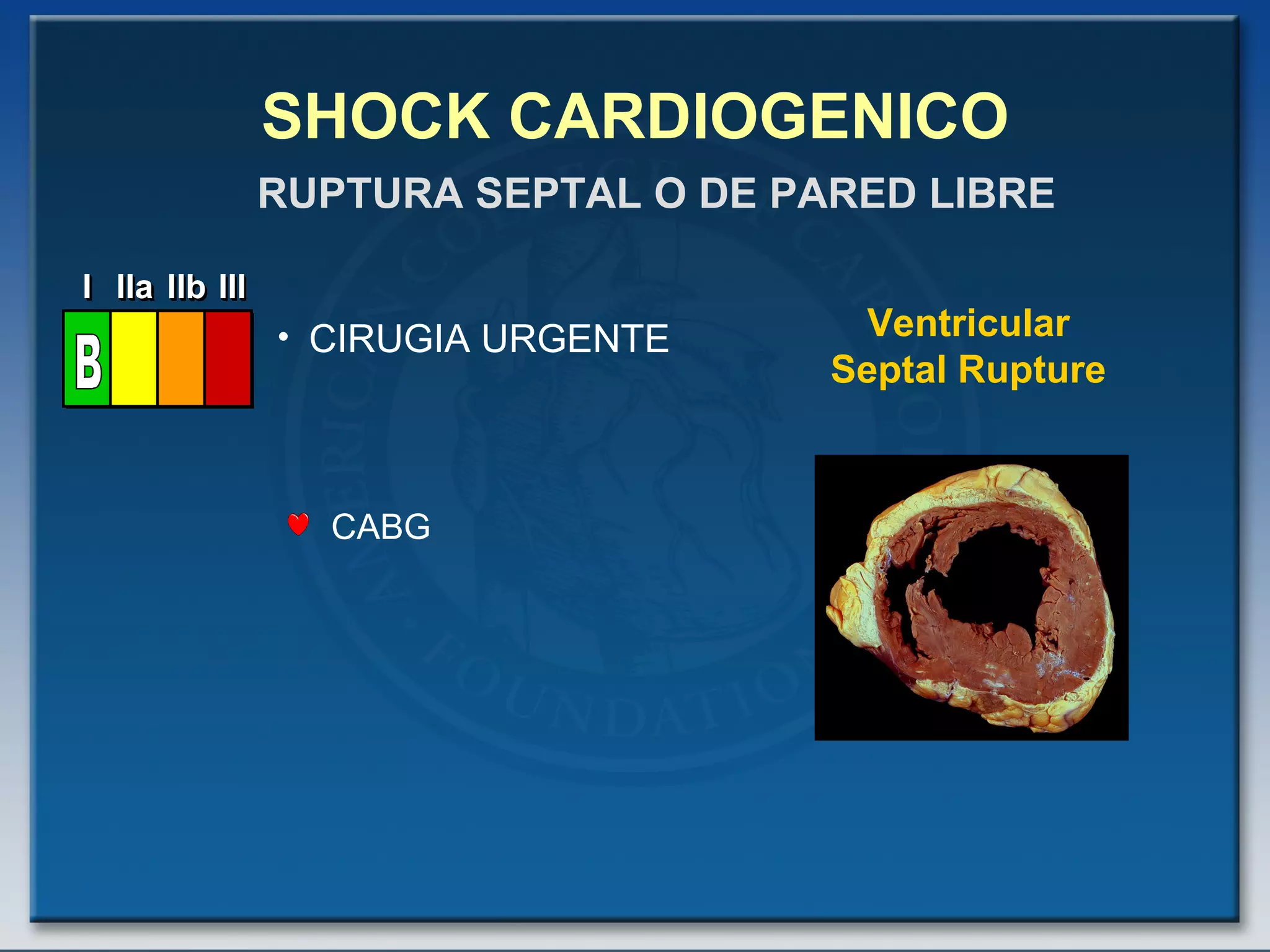 SHOCK CARDIOGENICO CIRUGIA URGENTE RUPTURA SEPTAL O DE PARED LIBRE CABG Ventricular Septal Rupture I I I IIa IIa IIa IIb IIb IIb III III III I I I IIa IIa IIa IIb IIb IIb III III III I I I IIa IIa IIa IIb IIb IIb III III III IIa IIa IIa IIb IIb IIb III III III B 