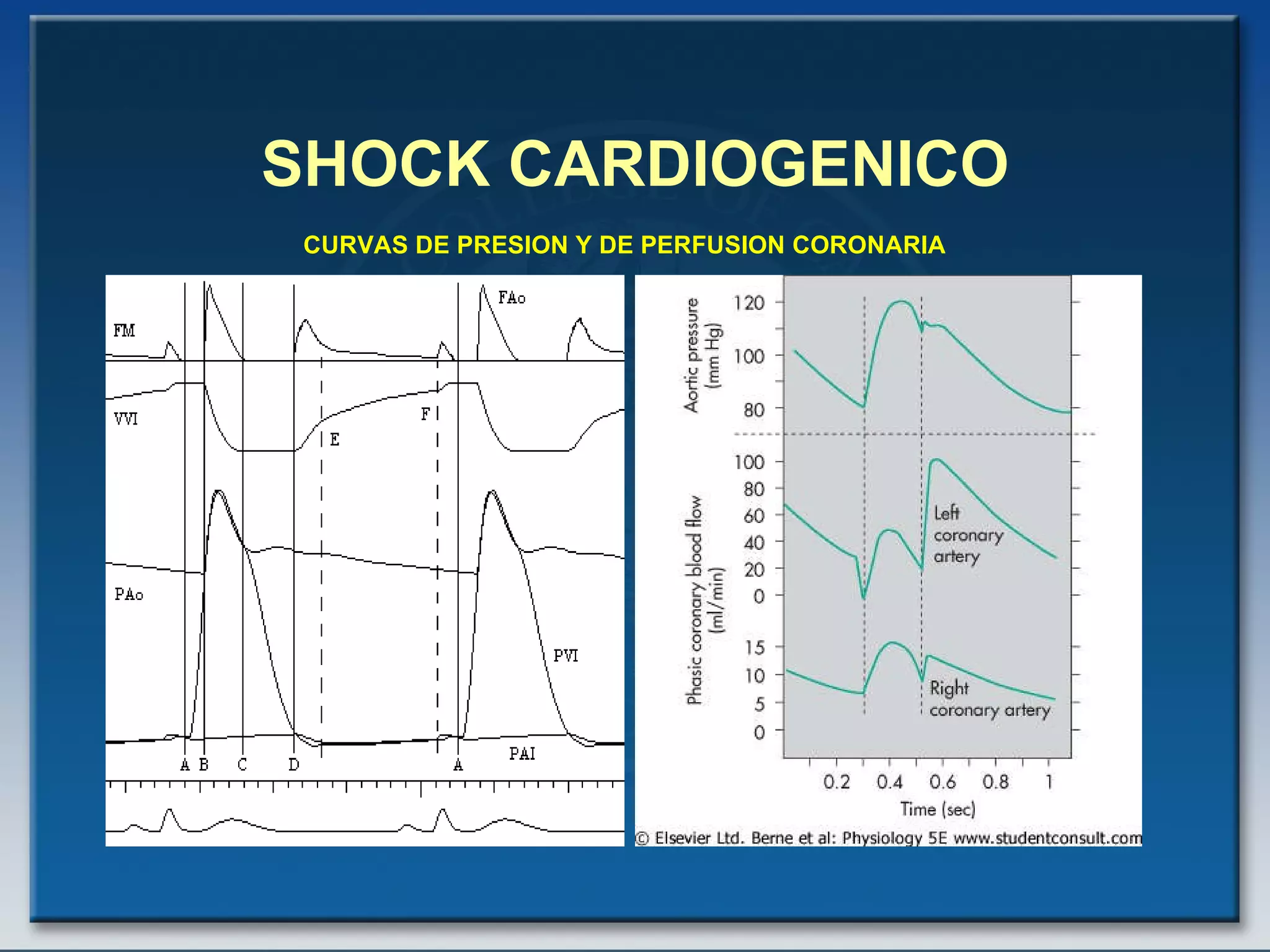 SHOCK CARDIOGENICO CURVAS DE PRESION Y DE PERFUSION CORONARIA 