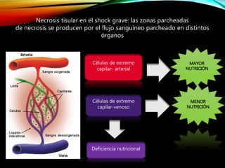Células de extremo
capilar- arterial
Células de extremo
capilar-venoso
MAYOR
NUTRICIÓN
MENOR
NUTRICIÓN
Deficiencia nutricional
Necrosis tisular en el shock grave: las zonas parcheadas
de necrosis se producen por el flujo sanguíneo parcheado en distintos
órganos
 