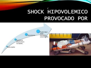SHOCK HIPOVOLEMICO
PROVOCADO POR
TRAUMATISMOS
 
