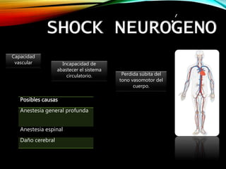 SHOCK NEUROGENO
Capacidad
vascular Incapacidad de
abastecer el sistema
circulatorio. Perdida súbita del
tono vasomotor del
cuerpo.
Posibles causas
Anestesia general profunda
Anestesia espinal
Daño cerebral
 