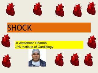 SHOCK
Dr Awadhesh Sharma
LPS Institute of Cardiology
 
