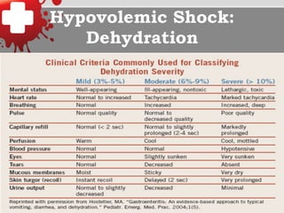 Hypovolemic Shock:
Dehydration
 