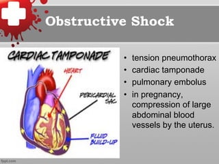 Obstructive Shock
•  tension pneumothorax
•  cardiac tamponade
•  pulmonary embolus
•  in pregnancy,
compression of large
abdominal blood
vessels by the uterus.
 
