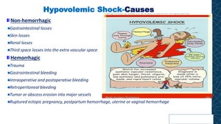 Hypovolemic Shock-Causes
Non-hemorrhagic
Gastrointestinal losses
Skin losses
Renal losses
Third space losses into the extra vascular space
Hemorrhagic
Trauma
Gastrointestinal bleeding
Intraoperative and postoperative bleeding
Retroperitoneal bleeding
Tumor or abscess erosion into major vessels
Ruptured ectopic pregnancy, postpartum hemorrhage, uterine or vaginal hemorrhage
 