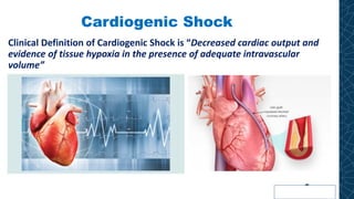 Cardiogenic Shock
Clinical Definition of Cardiogenic Shock is “Decreased cardiac output and
evidence of tissue hypoxia in the presence of adequate intravascular
volume”
 