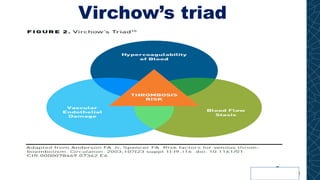 Virchow’s triad
 