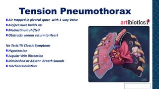 Tension Pneumothorax
Air trapped in pleural space with 1-way Valve
Air/pressure builds up
Mediastinum shifted
Obstructs venous return to Heart
No Tests!!!! Classic Symptoms
Hypotension
Jugular Vein Distention
Diminished or Absent Breath Sounds
Tracheal Deviation
 