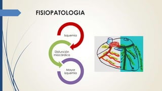 FISIOPATOLOGIA
Isquemia
Disfunción
miocárdica
Mayor
isquemia
 